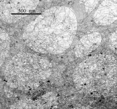 Vue d'ensemble en microscopie électronique à bas grandissement des nanotubes de nitrure de bore (cliché R. Arenal, LEM)