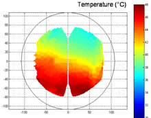 Distribution de température dans une goutte : mesure par LIF (Laser Induced Fluorescence)
