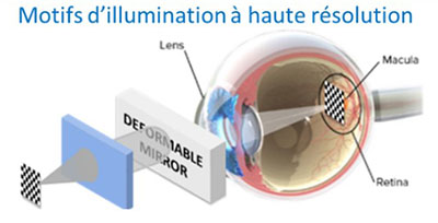 Concepts innovants pour l'imagerie biomédicale et la chirurgie ophtalmique laser